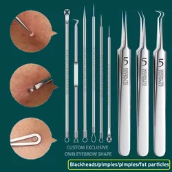 German Ultra-fine No. 5 Cell Pimples Blackhead Clip Tweezers Beauty Face Health Salon Special Blackhead Remover Acne Needle Tool