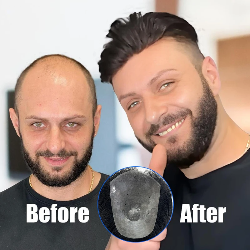 100% الشعر البشري 15*20 سنتيمتر بولي Men الرجال الطبيعية أملس الظهر نمط الشعرية الاصطناعية غطاء فعال ترقق الشعر شعر مستعار الذكور