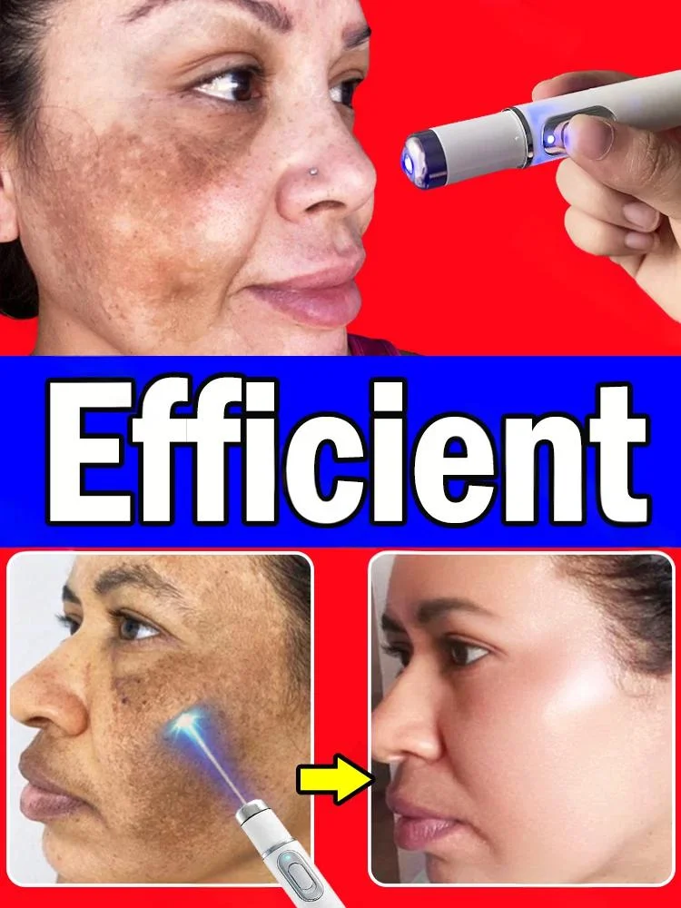 

Pʀᴇᴄɪsɪᴏɴ ᴛᴀʀɢᴇᴛᴇᴅ ʟᴀsᴇʀ sᴘᴏᴛ ʀᴇᴍᴏᴠᴀʟ ᴘᴇɴ, ᴘɪᴄᴏsᴇᴄᴏɴᴅ-ʟᴇᴠᴇʟ ᴘɪɢᴍᴇɴᴛ ʀᴇᴍᴏᴠᴀʟ, ᴀ ᴠᴇʀsᴀᴛɪʟᴇ sᴘᴏᴛ-ғᴀᴅɪɴɢ ɪɴsᴛʀᴜᴍᴇɴᴛ ғᴏʀ ғᴀᴄᴇ ᴀɴᴅ ʙᴏᴅ