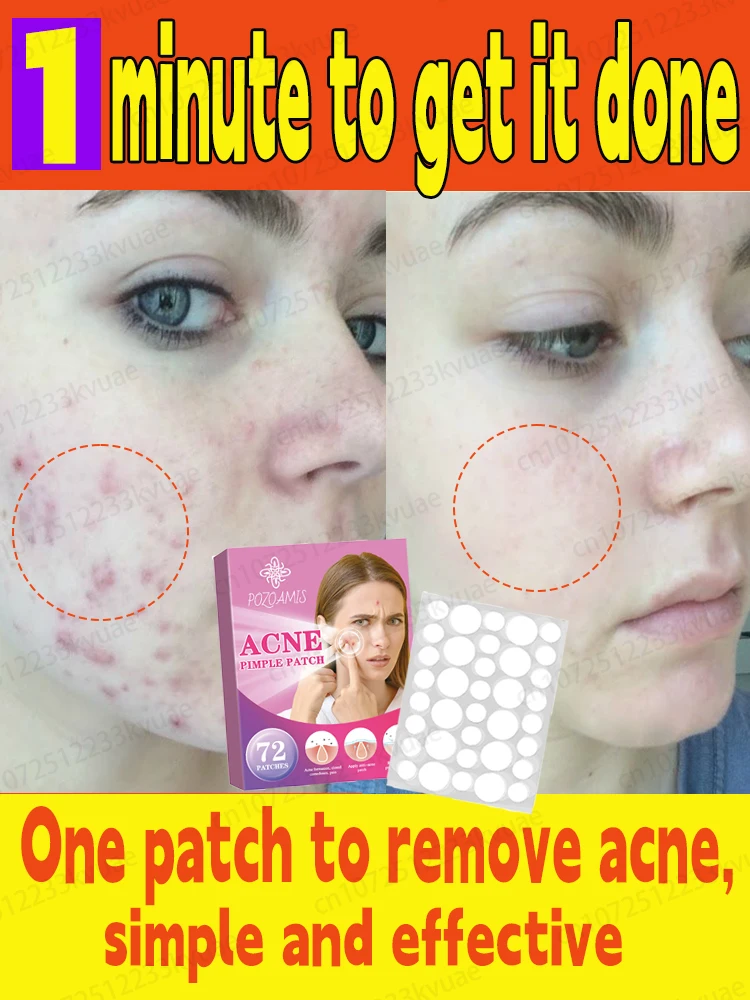 

Quick solution to skin problems