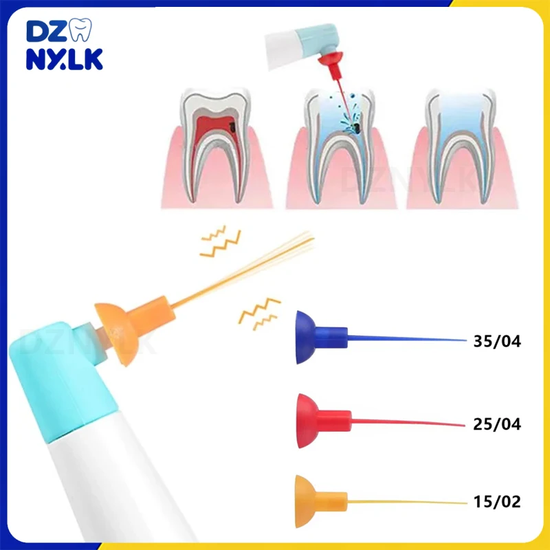 

20/60 шт., наконечники для стоматологического звукового ирригатора, эндо-активатор, наконечники для лечения корневых каналов, стоматология, беспроводной ультразвуковой наконечник для мытья зубов