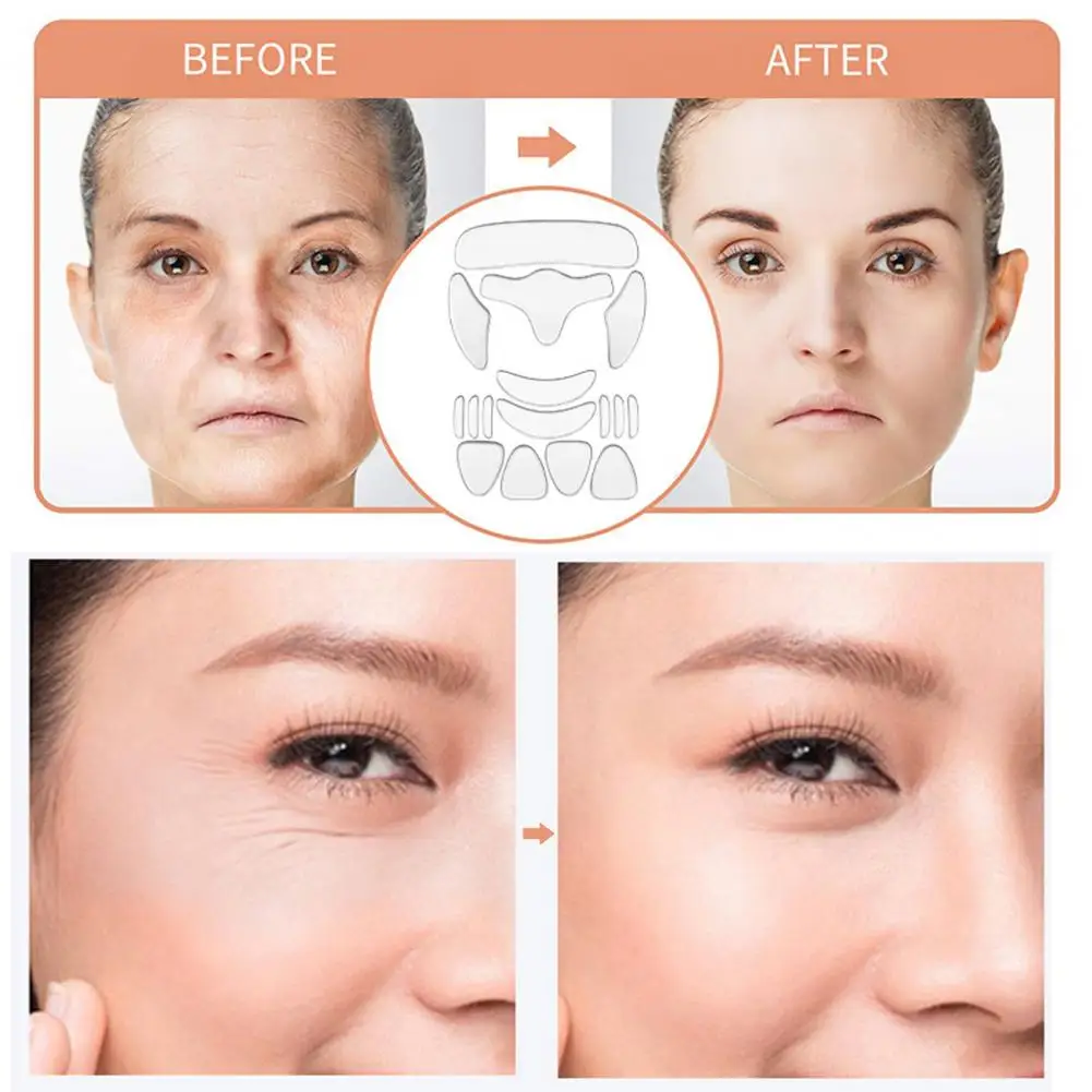 Silicone Wrinkle Patches Anti-wrinkle Silicone Face Patches Reusable Overnight Facial Wrinkle Remover Forehead Crow’s Feet
