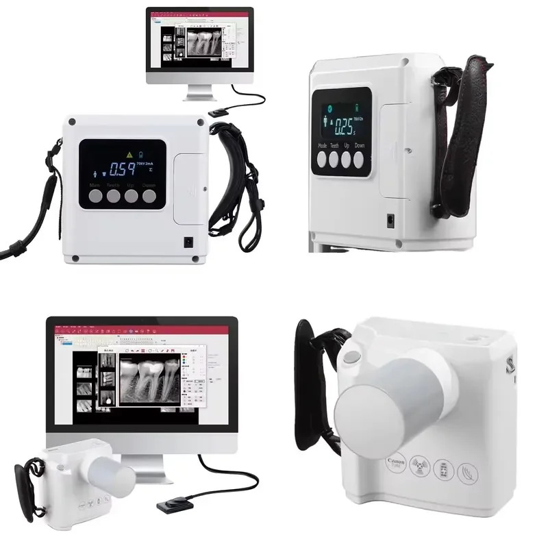 Portable Dental X Ray Machine for Digital Imaging Systems Dental RVG X Ray Units