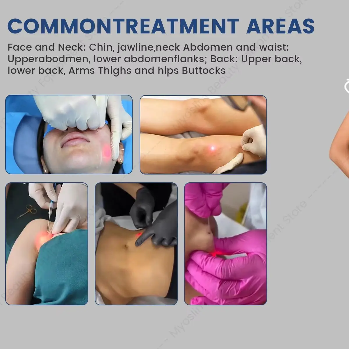 980nm 1470nm Lase Machine Dual Wavelength Multifunctional Large Area Lipolysis Skin Tightening Body Shaping Facial Lifting