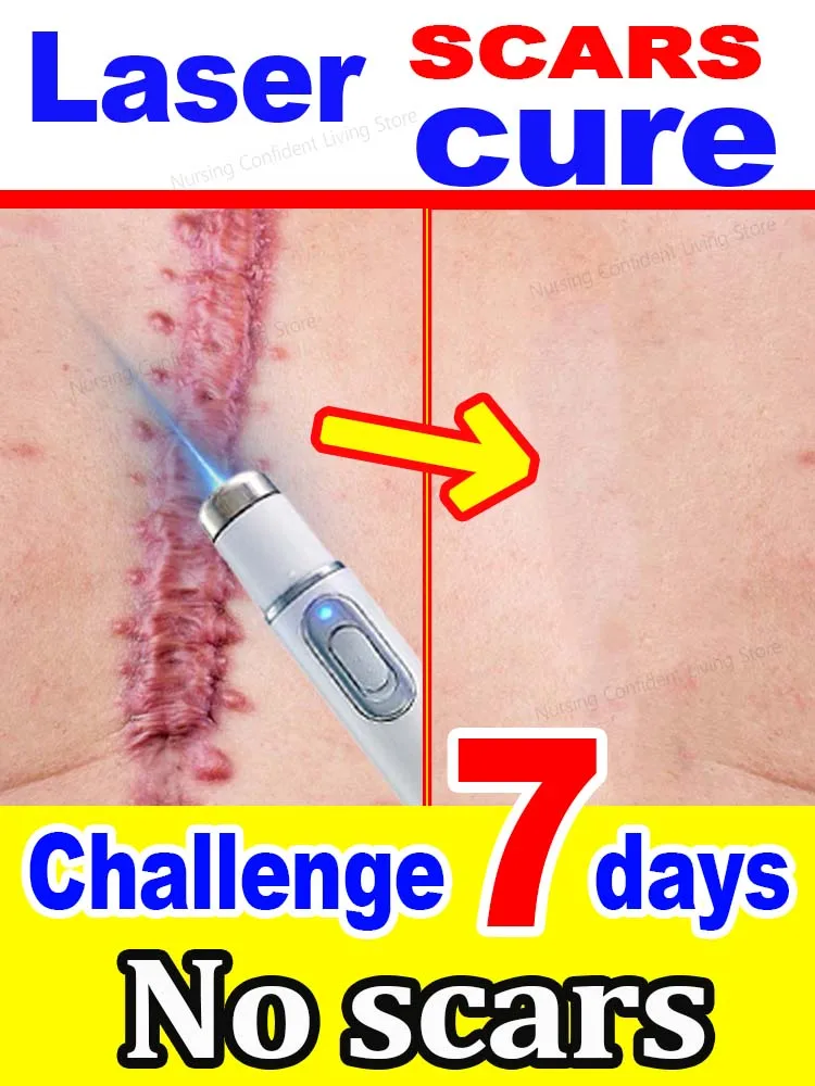 No scars, smooth skin