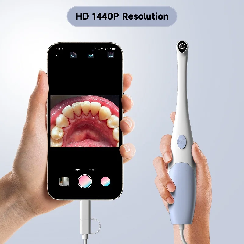 TYPE-C Visual Oral Camera for Iphone 2in1 Hand-held Dental Camera USB Mouth Tooth Inspection Endoscope 8LEDs for Android Phones view 5