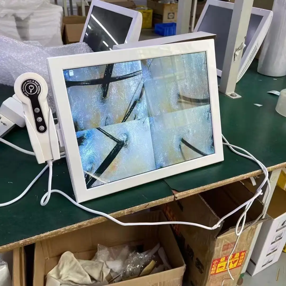 

Мини-камера для кожи головы 50x 200x, анализатор волос, тихоскоп, зеркало с искусственным интеллектом, анализ кожи головы, диагностическая камера для кожи головы