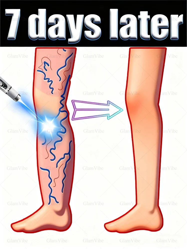 

Restore normal tendons and veins, no pain
