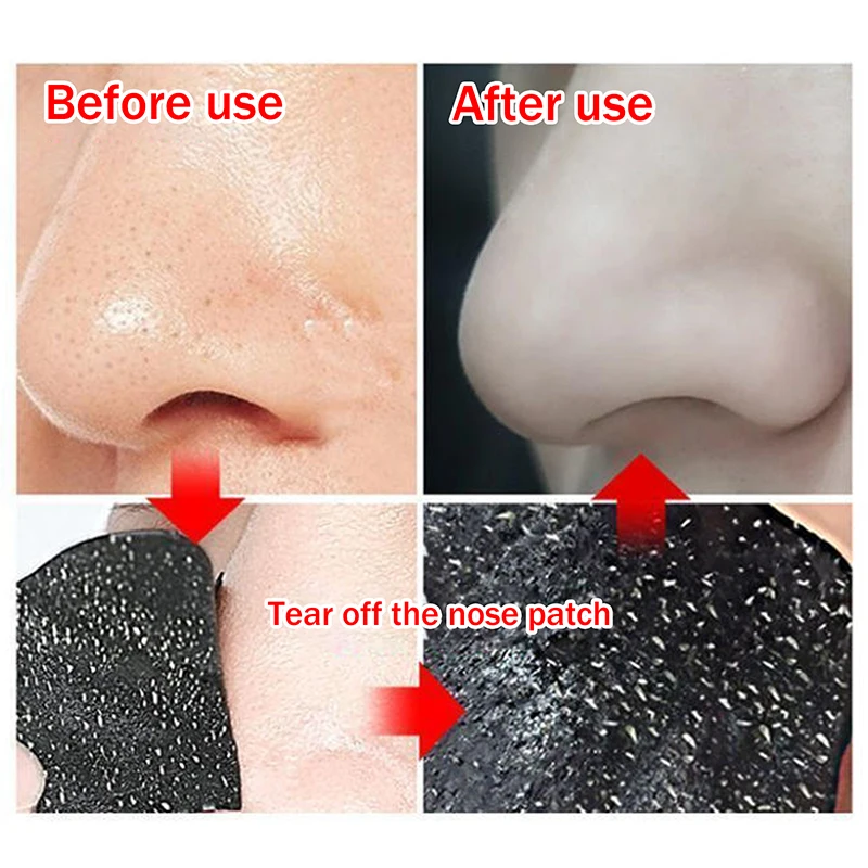 5/15/25/50Pcs Bamboo Charcoal Nose Pore Strips Deep-Cleaning Blackhead Removal Mask for Acne Care and Smooth Skin
