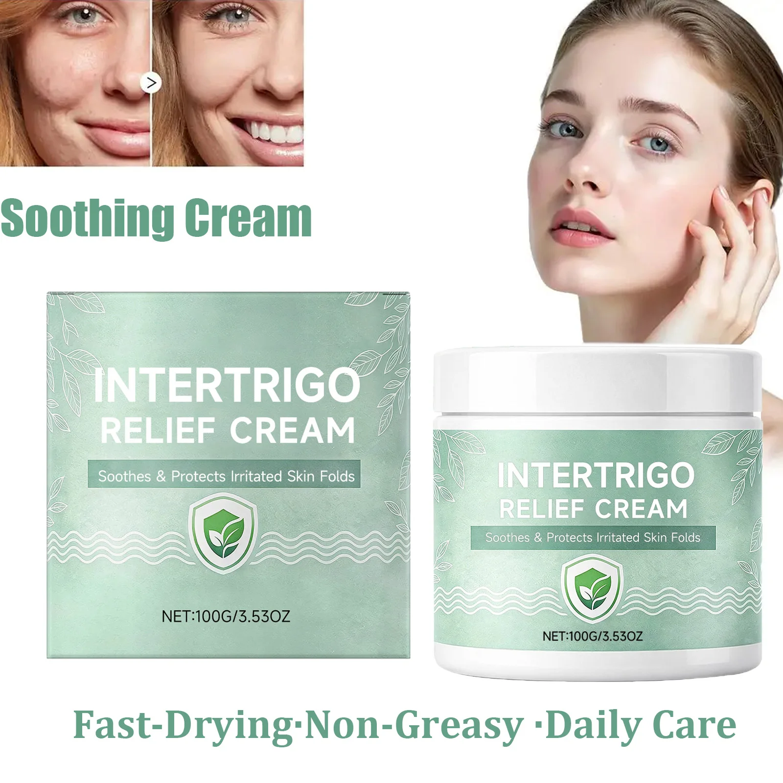 Skin Fold Soothing Cream Intertrigo Relief Helps Support Skin Comfort Moisture Friction Protection Fast-Drying Non-Greasy Smooth