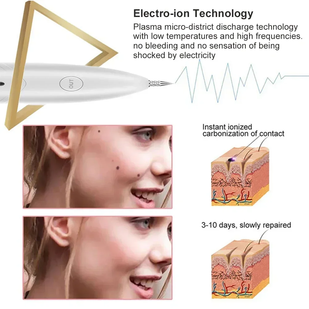 미니 레이저 플라즈마 펜 휴대용 주근깨 제거 기계, 피부 얼굴 사마귀 태그 제거 도구, 가정용 검은 점 문신 제거 장치