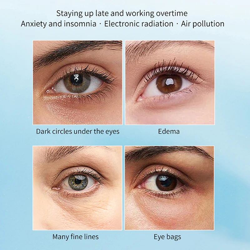 1/3Pairs For Deep Hydration To Smooth Crow's Feet And Puffy Eyes Micro-needle Eye Patch Mask Anti-Wrinkle Patches With Collagen
