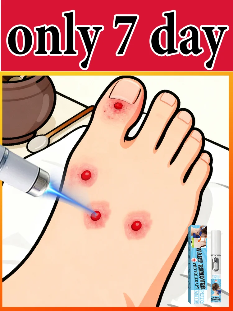 

ʙʟᴜᴇ ʟɪɢʜᴛ ᴘᴇɴ sᴏʟᴠᴇ ᴡᴀʀᴛs, ʜᴏᴛ sᴀʟᴇ ᴡᴀʀᴛ ᴄᴀʀᴇ ᴛᴏᴏʟs