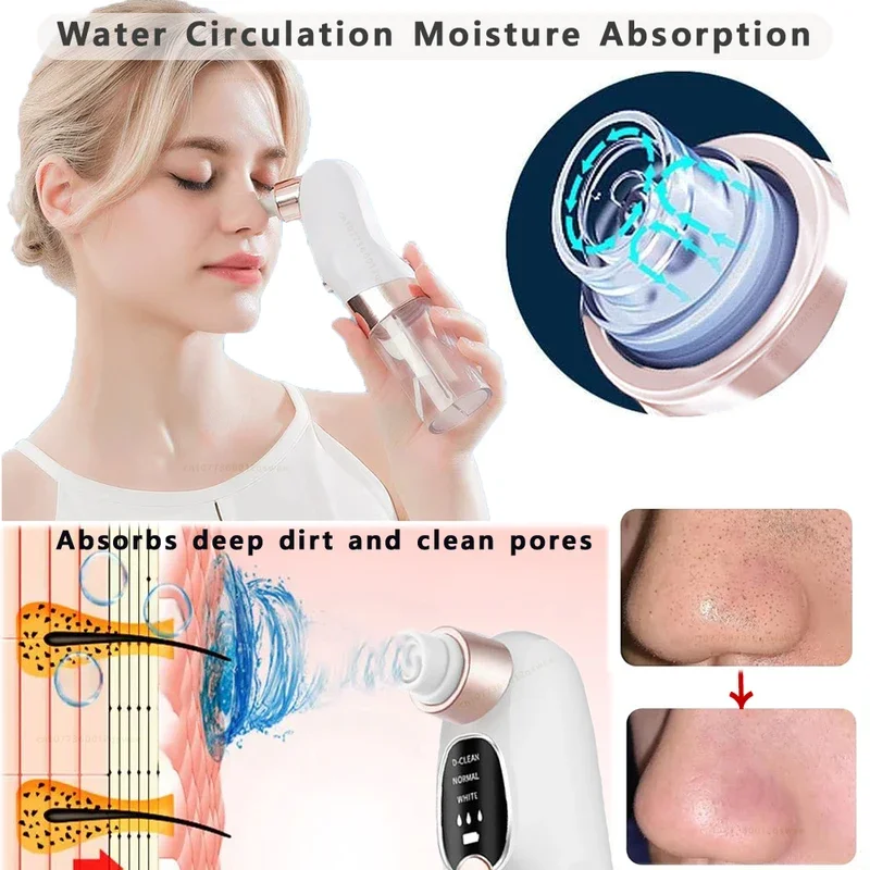 Blackhead Remover Pore Vacuum Face Cleaner Electric Pimple Acne Black Head Removal USB Rechargeable Water Cycle Black Dot Remove image 3