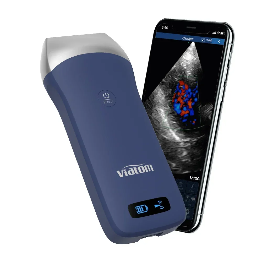 

Viatom Portable Ultrasound Linear Probe Scanning Depth 20-55mm Wireless Ultrasound Scanner