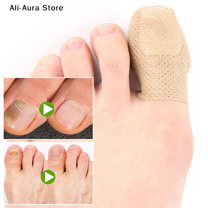 10Pcs Toenail Fungus Patch Nail Repair Patches Nail Ingrown Correction Stickers For Discolored Or Damaged Nails Care