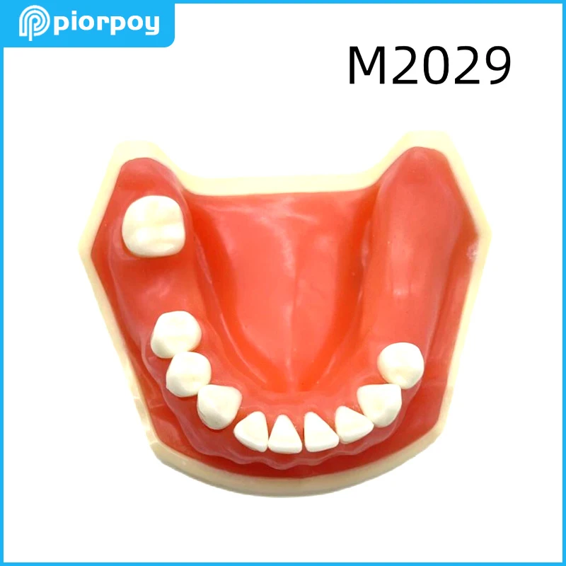 Dental Teaching Models Mandibular Implant Education Practice Soft Gum Mold Dentistry Demonstration Students Training Tools M2006