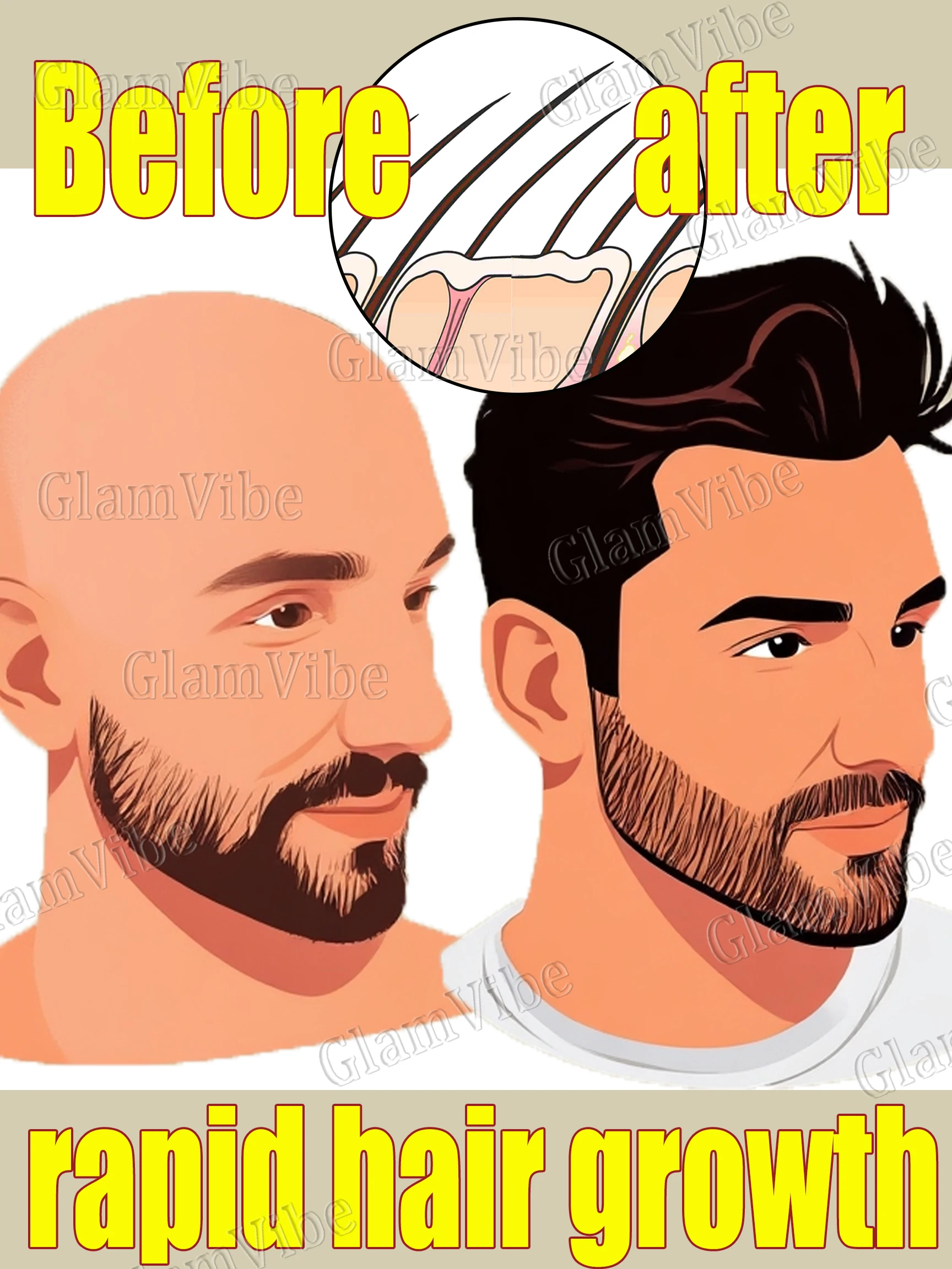 

Сохраняет поры заборонено для поднятия плотности волос.