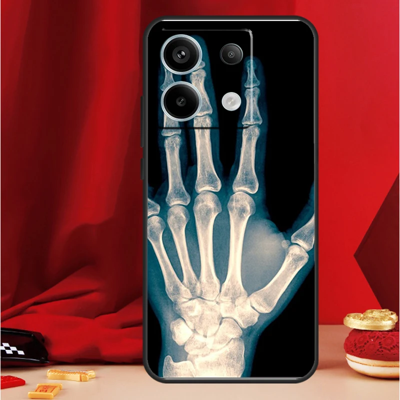 X-Ray 인체 해부학 케이스 Xiaomi Redmi Note 11 12 13 Pro 8 9 10 Note 12S 11S 10S 9S Redmi 13C 10C 12C 커버