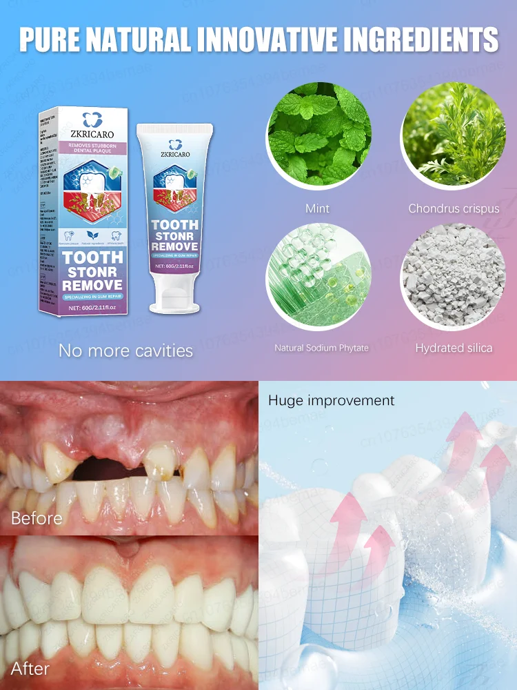 معجون أسنان لتبييض الأسنان - تركيبة إنزيم، إزالة البقع، التنظيف العميق، نفس منعش، شحن مجاني