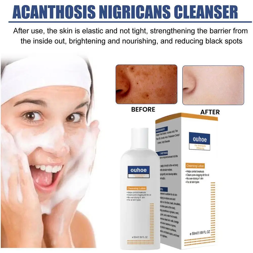 Limpador facial hidratante e clareador, espuma de limpeza profunda, limpeza profunda da pele, aminoácido e controle do óleo