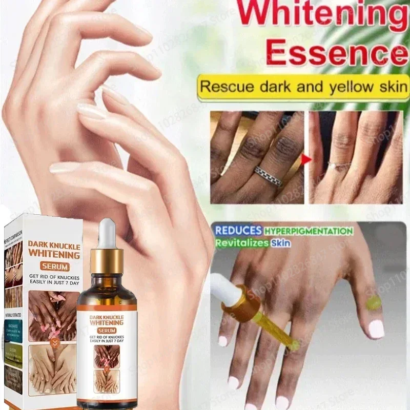 

Skin Whitening Private Parts Underarm Bleaching Serum Whiten Butt Knee Brighten Inner Thigh Arm Body Remove knuckles whitening