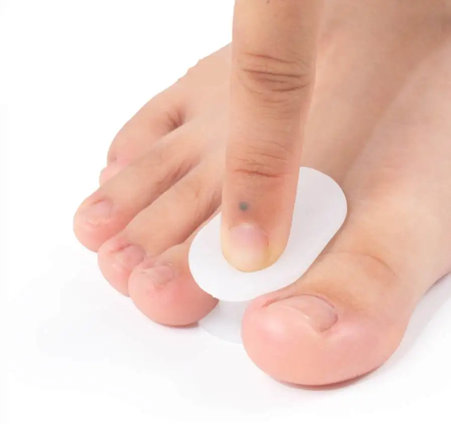1/10Pairs I-shaped Toe Separators for Bunions Toe Straightener for Aligning and Correcting Toes Prevent Blisters Calluses Corns