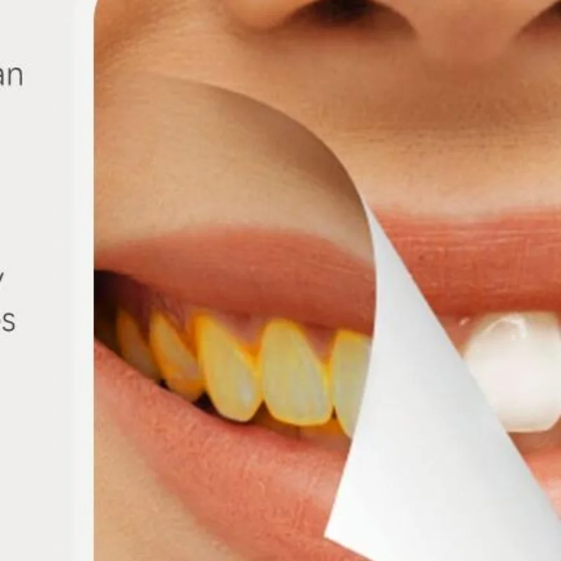 Teeth Whitening Toothpaste Probiotic Formula Stain Remover Fresh Breath Support Periodontitis Protection For Family