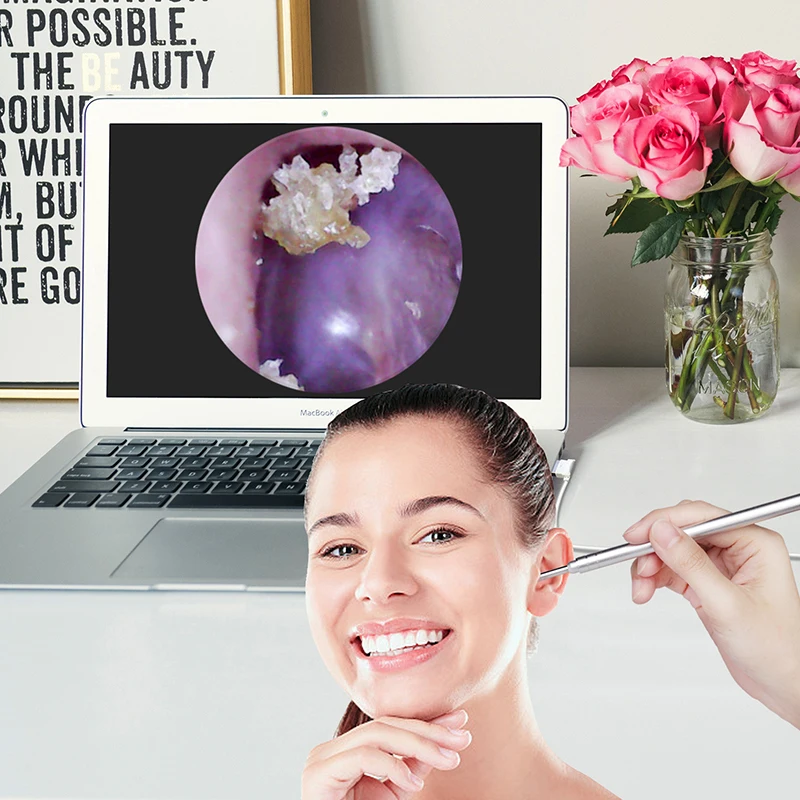 2MP 3.9mm EarPick Endoscope Camera Ear Wax Removal Otoscope Inspection Earscope Cleaner 3in1 USB Ear Camera