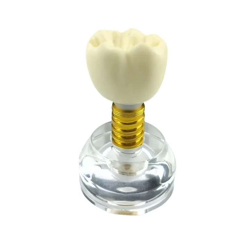 Crystal dental implant model, transparent dental model, teaching doctor-patient communication model, clinic ornament dentistry