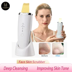 Ultrasonic Skin Scrubber Blackhead Exfoliation Dead Skin Cleansing Spatula Deep Cleansing Scraper Facial Lifting Firming Skincar