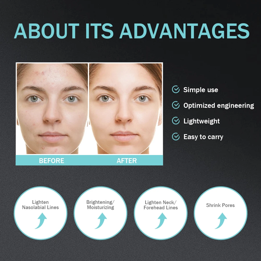 face-saving equipment, anti-aging and anti-wrinkle electric radio frequency beauty instrument, home eye massager