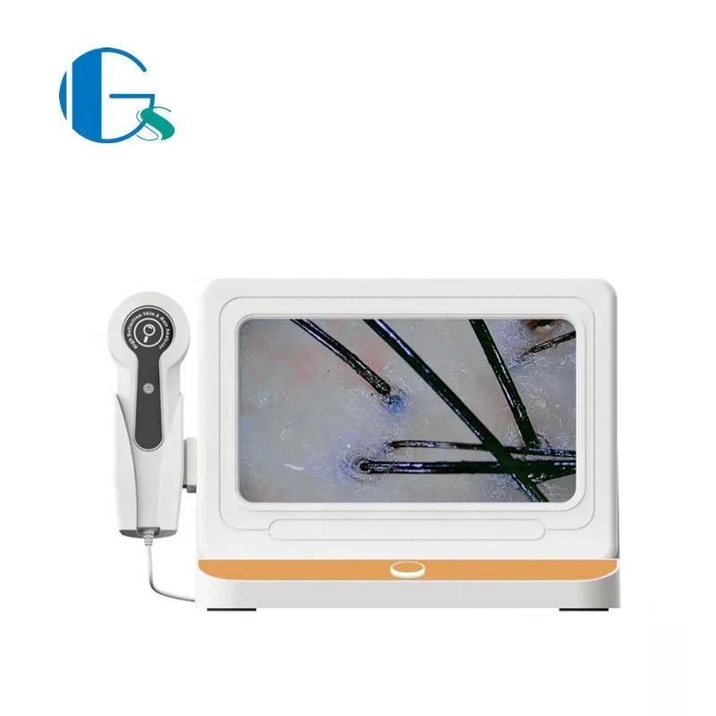 And Scalp Hair Analysis Machine hair analyzer hair scope test device