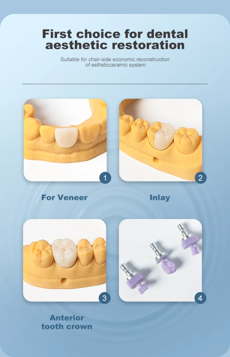 LODDEN Deatal Metarial B40 40-15-15 Lithium-Disilikat-Blöcke LT/HT/MT Dentallabor Glaskeramik für CAD-CAM-Block 4 Stück – Detail 4