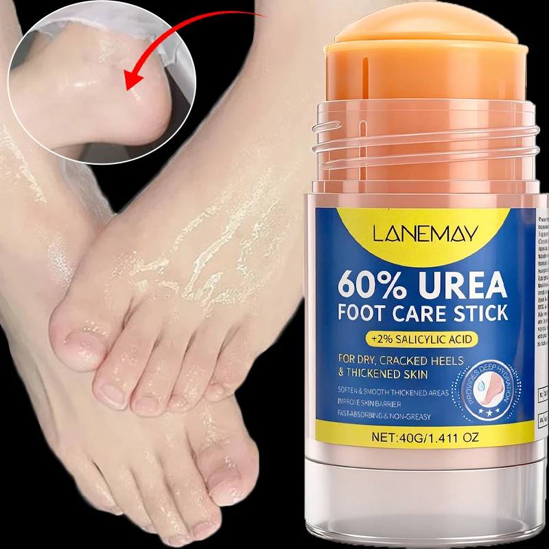 Hydration Moisturizing Foot Cream Dry Cracked Heel Anti-crack feet Protection Cream Skin Repair Intense Hydra Callus Remover 40g