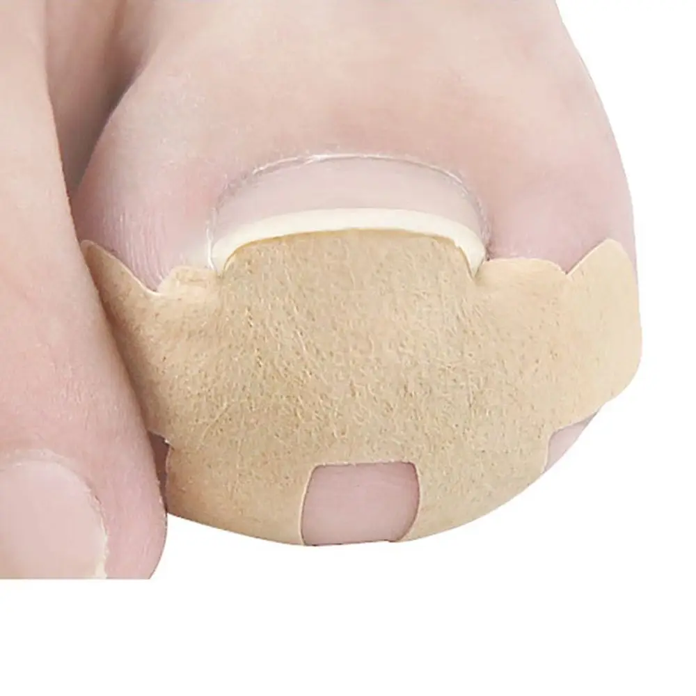 Paronychia Treatment Fixer Nail Care Patch Pedicure Tools Toenail Treatment Corrector Stickers adesivi per unghie incarnite