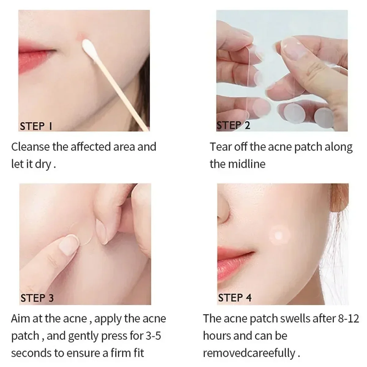 120pcs Invisible Acne Patches Removal Pimple Anti-Acne Hydrocolloid Patches Spots Marks Concealer Repair Sticker Waterproof