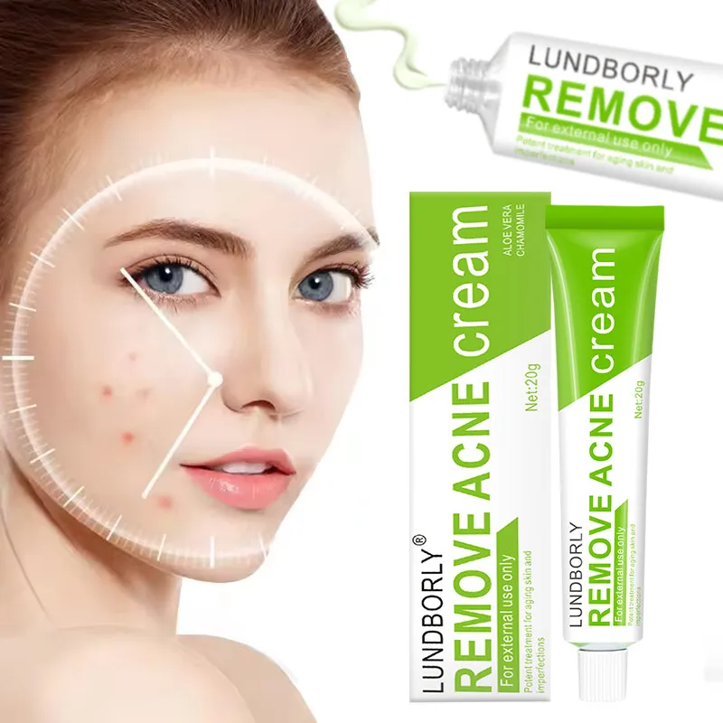 Crème pour le visage à base de plantes naturelles, 20g, crème contre l'acné avec acide salicylique, contrôle de l'huile, hydratante, décoloration, marques d'acné, douce, Non irritante
