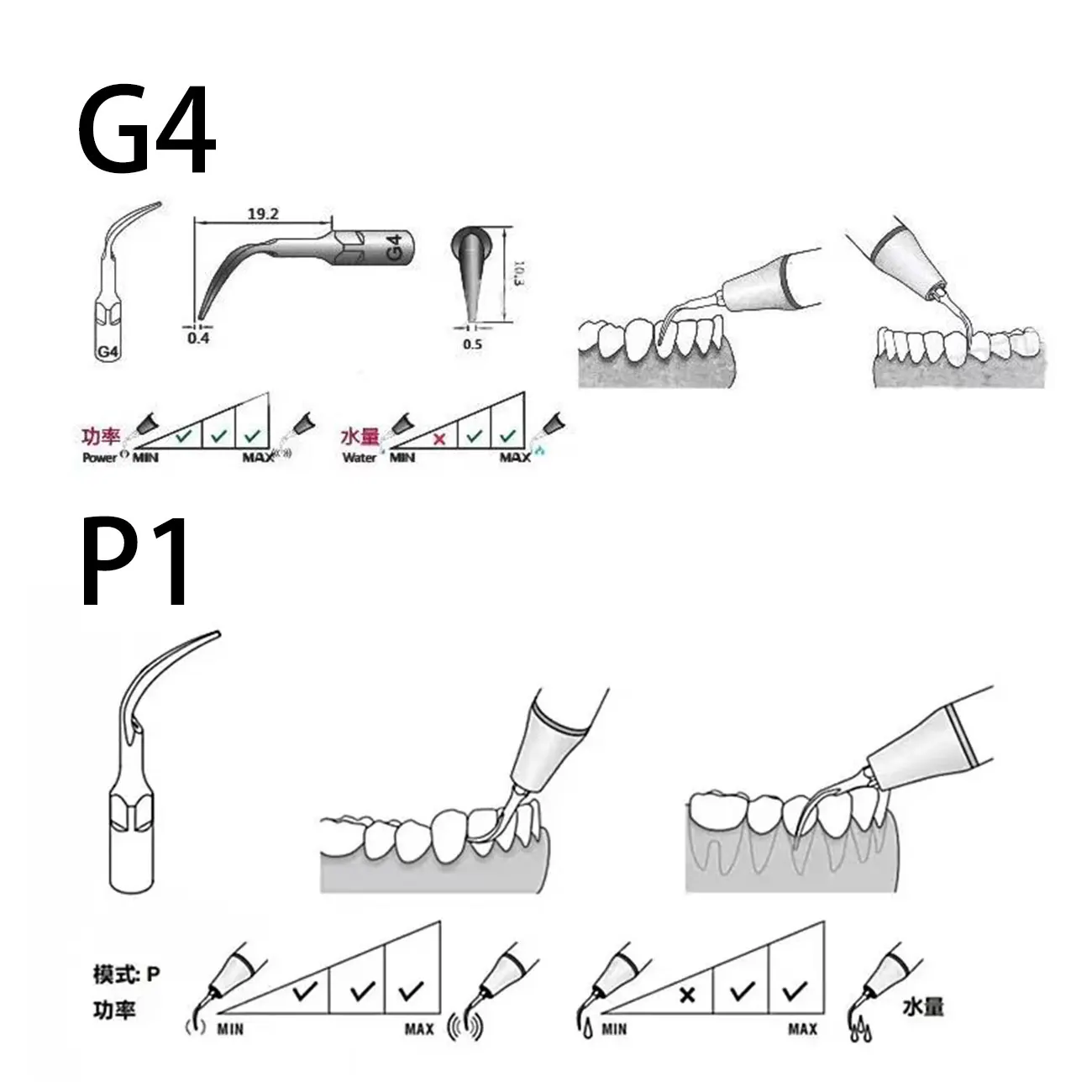 5 pz Dentale Ad Ultrasuoni Scaler Punta Scaling Punta Periodonzia Endodonzia Fit Picchio EMS