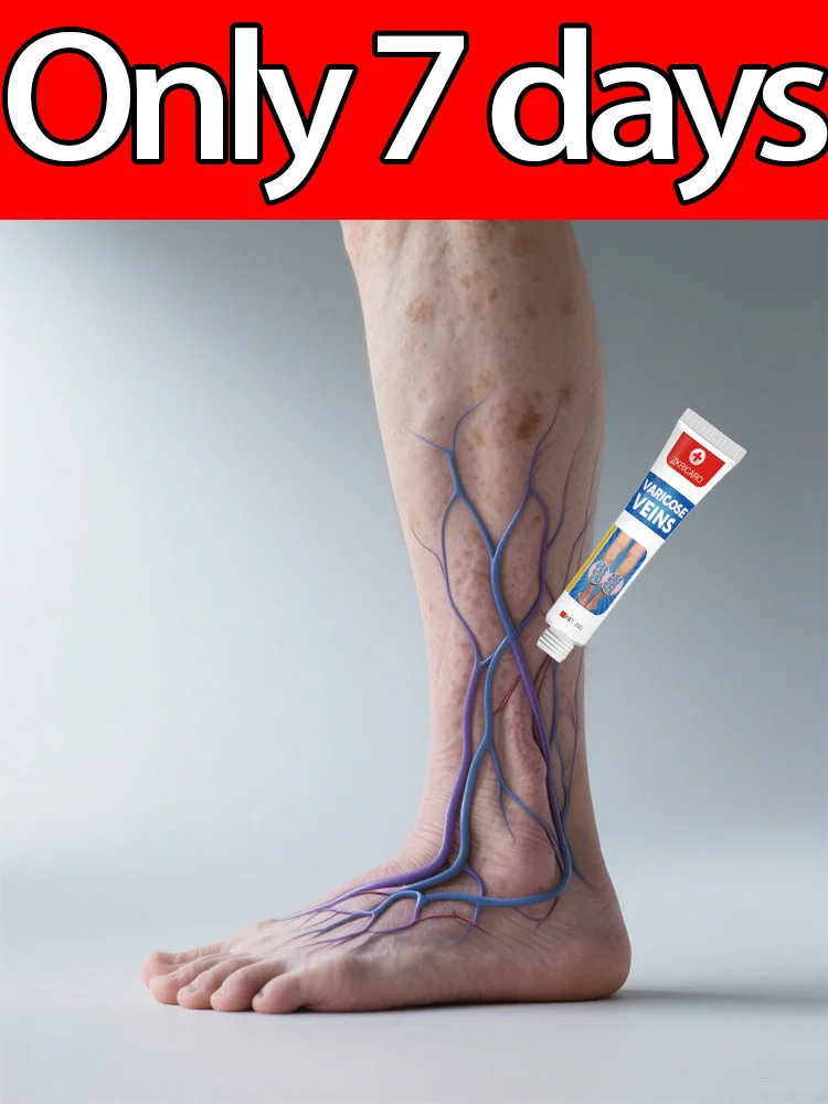 Wᴇᴀʀ Sʜᴏʀᴛs Wɪᴛʜ Cᴏɴғɪᴅᴇɴᴄᴇ: Vᴀʀɪᴄᴏsᴇ Cʀᴇᴀᴍ Tʜᴀᴛ Sᴜᴘᴘᴏʀᴛs Yᴏᴜʀ Vᴇɪɴs