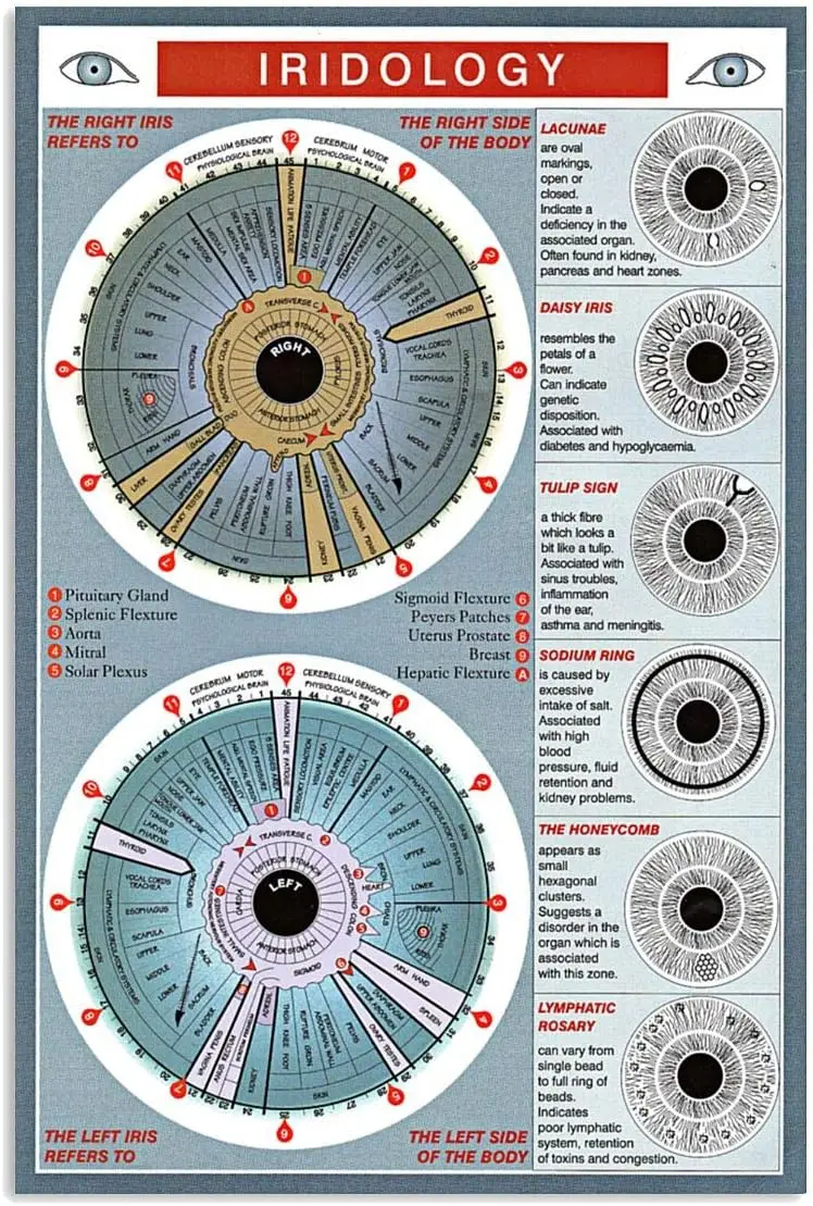 JIUFOTK Iridology Knowledge Posters Optometrist Science Guide Metal Signs Room Club Home Decor Wall Decor Vintage Plaque 8x sign