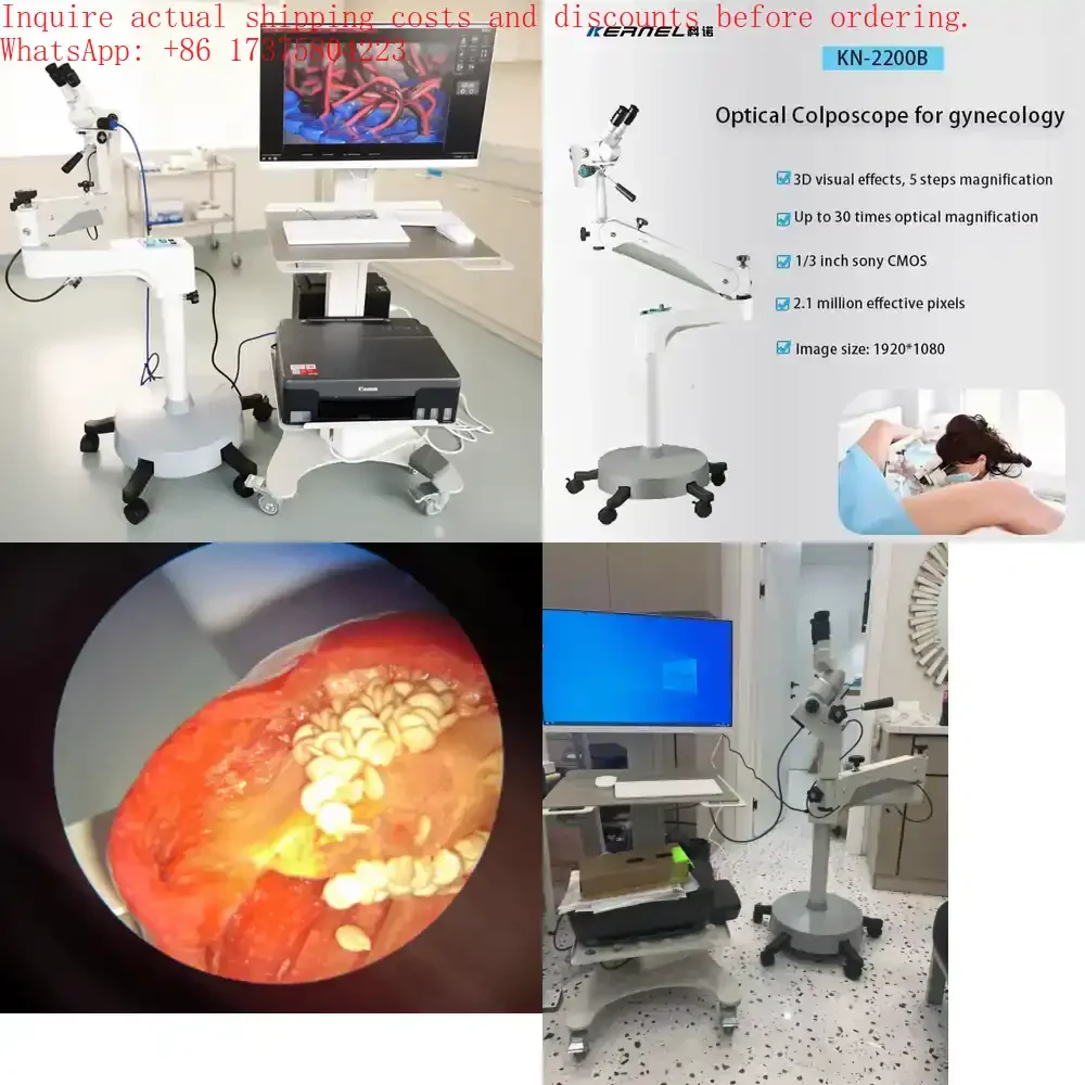 Diagnostic instrument Kernel KN-2200B Binocular colposcopy 2.1MP CE certified, designed for gynecological examination