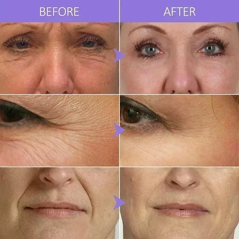 Anti-Rimpel Essence Lifting Verstevigende Afnemende Fijne Lijntjes Anti-Aging Serum Whitening Verheldering Voedende Gezichtsverzorging