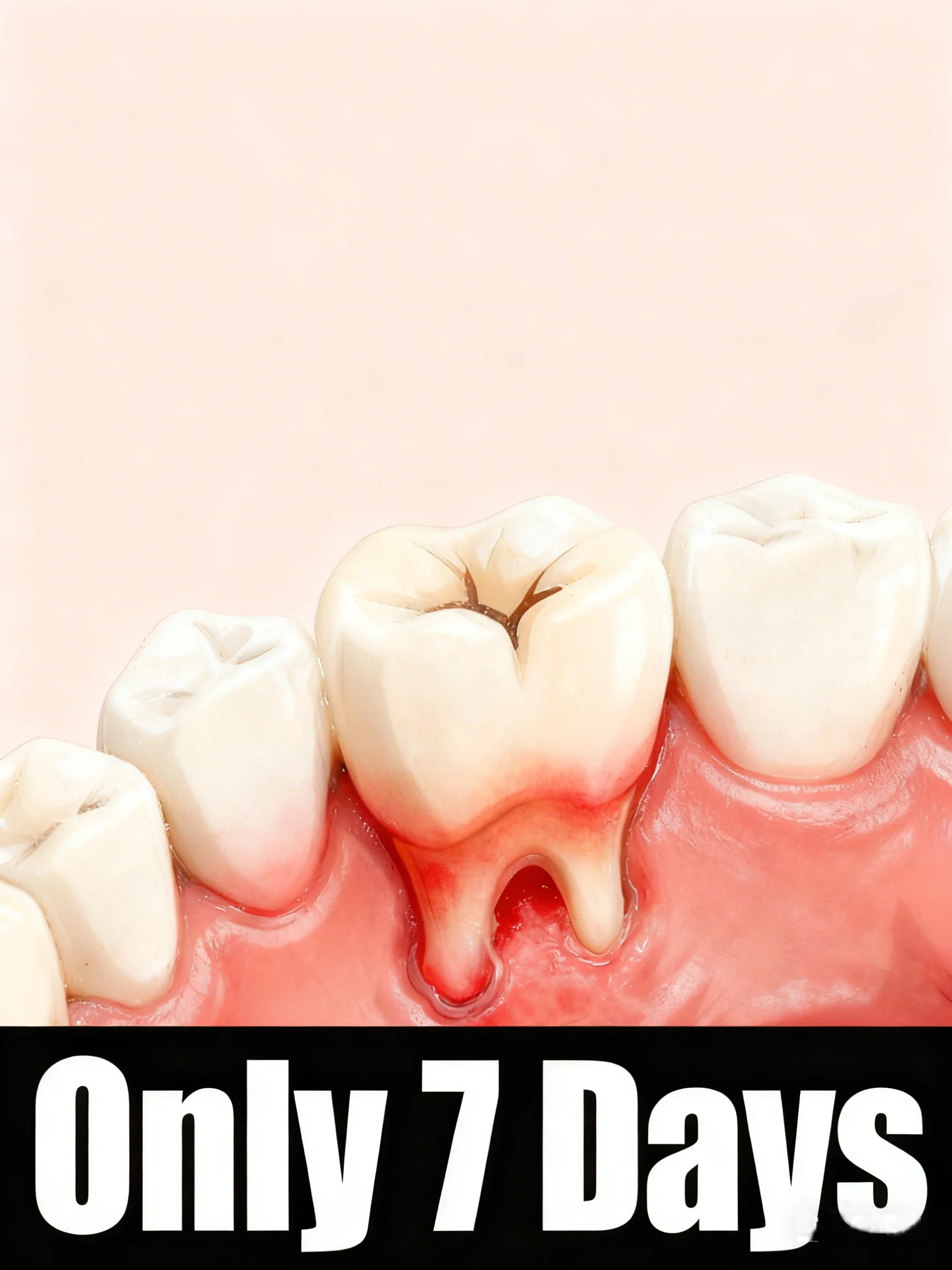 

Легко восстанавливает здоровье десен за 7-днем с помощью инструментов для ухода за зубами.