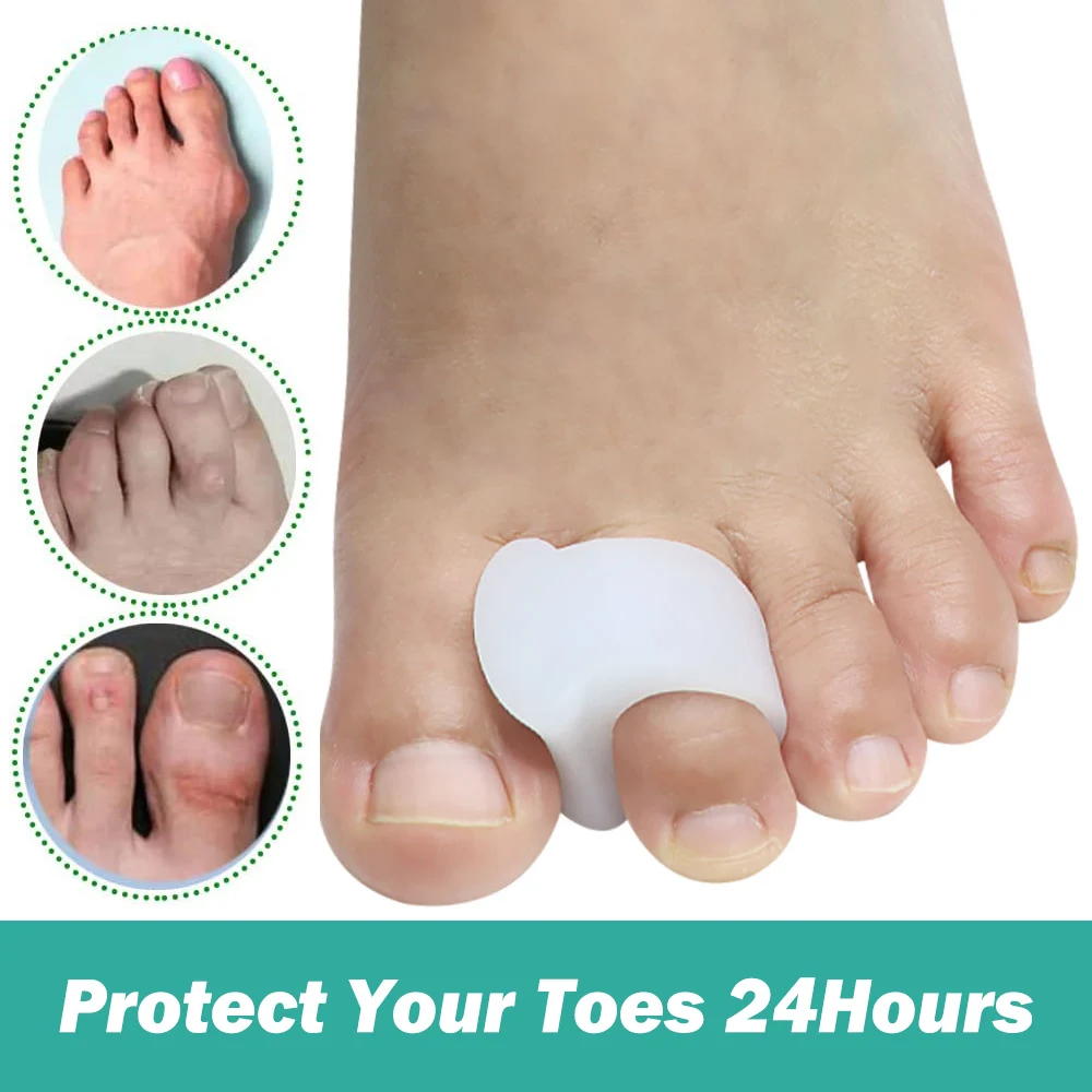 Pexmen 2Pcs Bunion Correctors for Women and Men Big Toe Spacer Pain Relief Gel Pads Straighten and Align Overlapping Toes