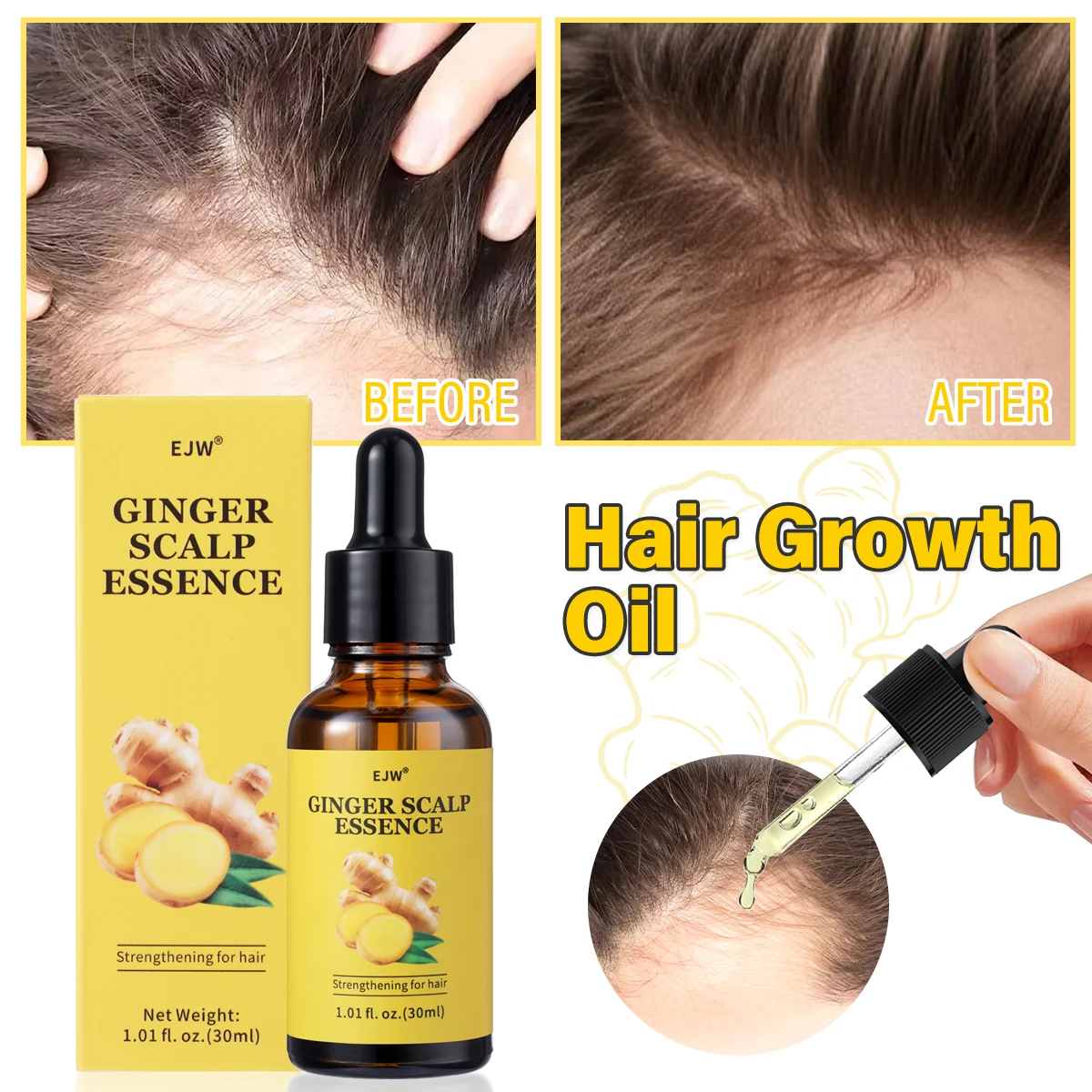 

Ginger Hair Growth Oil for Hair Growth Scalp Oil &Dry Scalp Treatment Ginger Shampoo and Hair conditioner for Hair Strengthening