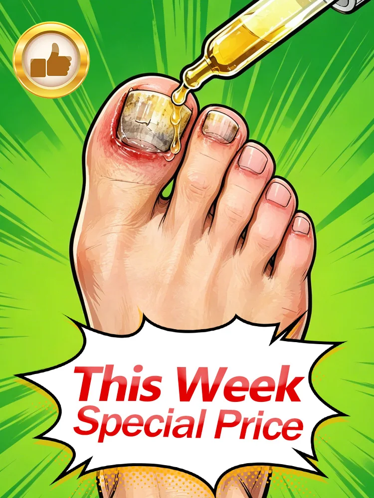 Foot‑Grooming Nail Care Tonic, Easy Dropper Application, Nourishes Nail Layers for Pleasing Cosmetic Appearance