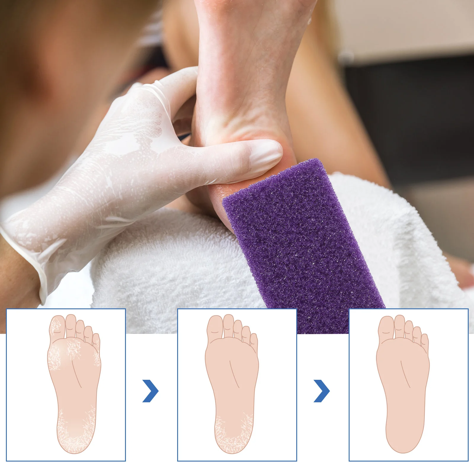 6pcs Foot Pumice Stone Block Callus Remover Scrubber For Foot Care Exfoliating Pedicure Tool Travel Size Rough Grip Smooth Skin
