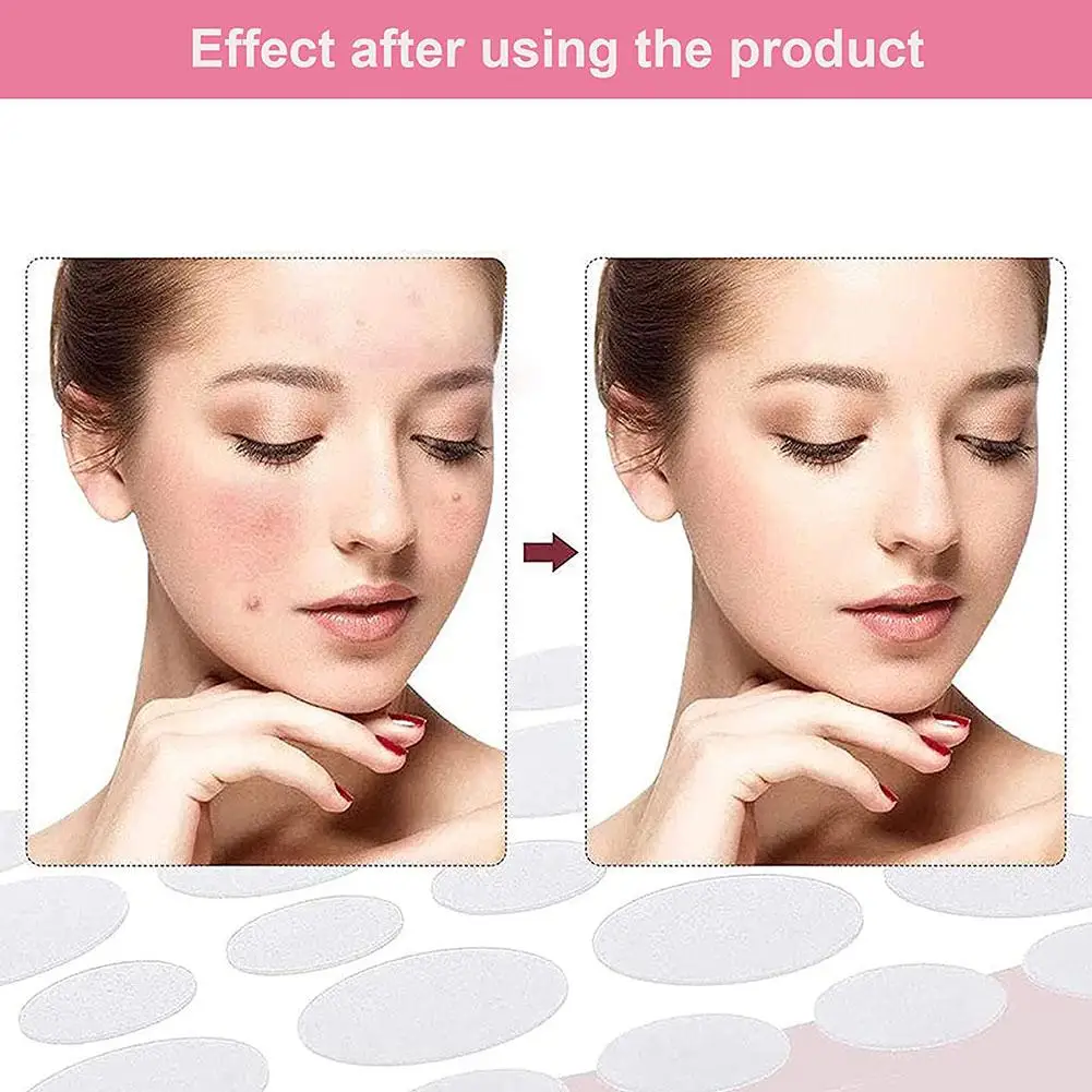 24 Patches Acne Patch Acne Pimple Patch Stickers Day Blemish Care Beauty Blackhead Face Removers Use Night Skin Hydrocolloi S3Z8