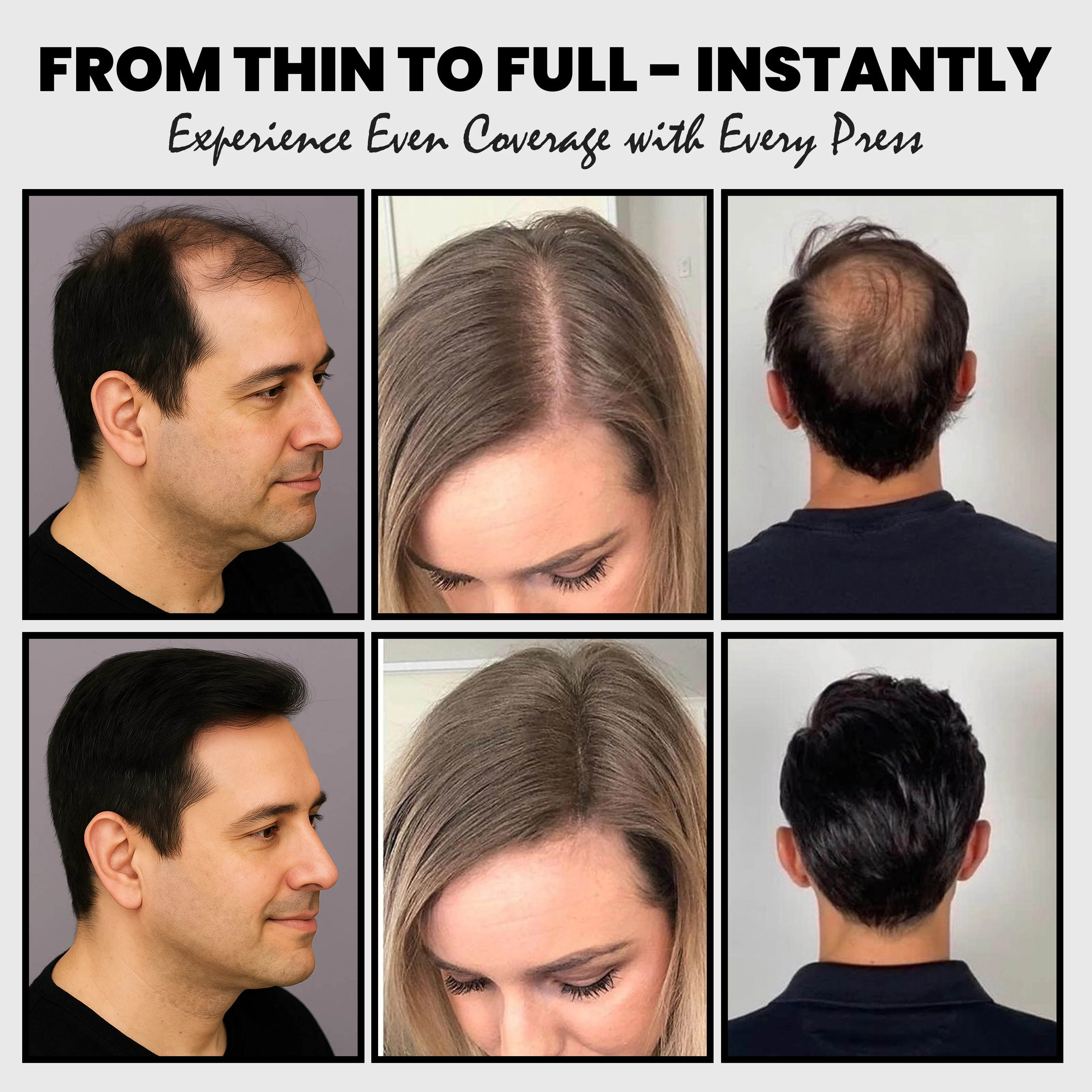 Adglamful 30g Hair Building Fiber - Spray Head Design, Precise Coverage, 5 Sec Quick Thickening for Sparse Areas & Styling